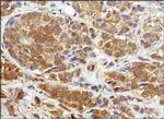 NQO1 Antibody in Immunohistochemistry (Paraffin) (IHC (P))