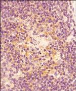 Caspase 3 Antibody in Immunohistochemistry (Paraffin) (IHC (P))