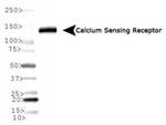 Calcium Sensing Receptor Antibody in Western Blot (WB)