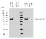 Cytokeratin 18 Antibody in Western Blot (WB)