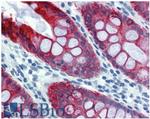 Cytokeratin 18 Antibody in Immunohistochemistry (Paraffin) (IHC (P))