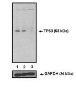 p53 Antibody