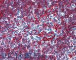 HLA-DR/DP Antibody in Immunohistochemistry (Paraffin) (IHC (P))