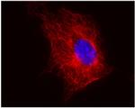 beta Tubulin Antibody in Immunocytochemistry (ICC/IF)