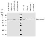 beta Tubulin Antibody in Western Blot (WB)