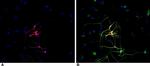 beta-3 Tubulin Antibody in Immunocytochemistry (ICC/IF)