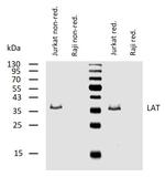 LAT Antibody in Western Blot (WB)