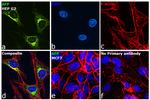 AFP Antibody