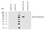 AFP Antibody in Western Blot (WB)