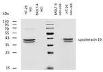 Cytokeratin 19 Antibody in Western Blot (WB)