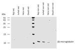 beta-2 Microglobulin Antibody in Western Blot (WB)