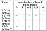 Blood Group A Antigen Antibody in Agglutination (AGG)