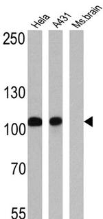 alpha Catenin Antibody in Western Blot (WB)