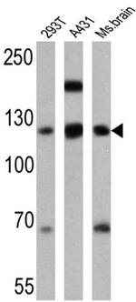 P-cadherin Antibody in Western Blot (WB)