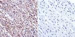 GRK2 Antibody in Immunohistochemistry (Paraffin) (IHC (P))