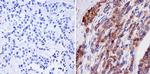 NMDAR2B Antibody in Immunohistochemistry (Paraffin) (IHC (P))