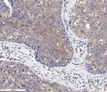 Phospho-AKT1 (Ser473) Antibody in Immunohistochemistry (Paraffin) (IHC (P))