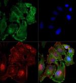 TBK1 Antibody in Immunocytochemistry (ICC/IF)