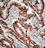 Nucleolin Antibody in Immunohistochemistry (IHC)