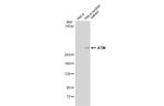 ATM Antibody in Western Blot (WB)