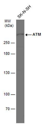 ATM Antibody in Western Blot (WB)