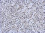 ATM Antibody in Immunohistochemistry (Paraffin) (IHC (P))