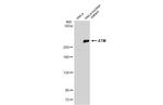 ATM Antibody in Western Blot (WB)