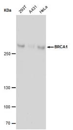 BRCA1 Antibody in Western Blot (WB)