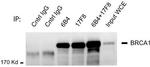 BRCA1 Antibody in Immunoprecipitation (IP)