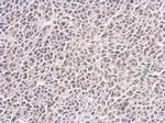 CENPF Antibody in Immunohistochemistry (Paraffin) (IHC (P))