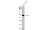 E2F1 Antibody in Western Blot (WB)