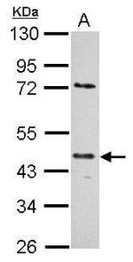 E2F1 Antibody in Western Blot (WB)