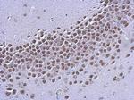 Estrogen Receptor beta Antibody in Immunohistochemistry (Paraffin) (IHC (P))