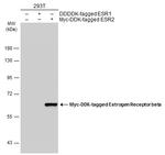 Estrogen Receptor beta Antibody in Western Blot (WB)