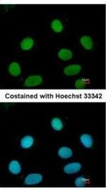 FEN1 Antibody in Immunocytochemistry (ICC/IF)