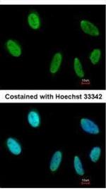 SAFB Antibody in Immunocytochemistry (ICC/IF)