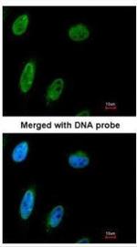 NBS1 Antibody in Immunocytochemistry (ICC/IF)