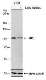 NBS1 Antibody