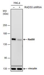 RAD50 Antibody