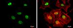 RAD50 Antibody in Immunocytochemistry (ICC/IF)