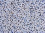 RAD50 Antibody in Immunohistochemistry (Paraffin) (IHC (P))