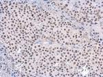 RAD50 Antibody in Immunohistochemistry (Paraffin) (IHC (P))