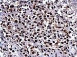 RAD50 Antibody in Immunohistochemistry (Paraffin) (IHC (P))