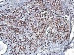 RAD50 Antibody in Immunohistochemistry (Paraffin) (IHC (P))