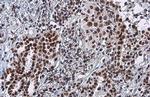 RAD50 Antibody in Immunohistochemistry (Paraffin) (IHC (P))