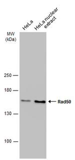 RAD50 Antibody in Western Blot (WB)