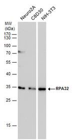 RPA2 Antibody in Western Blot (WB)