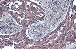 TSG101 Antibody in Immunohistochemistry (Paraffin) (IHC (P))