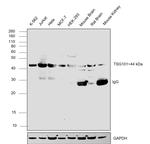 TSG101 Antibody in Western Blot (WB)