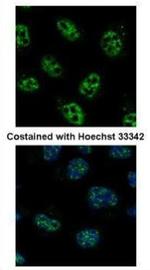 PCNA Antibody in Immunocytochemistry (ICC/IF)